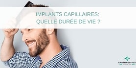 la duree de vie des implants capillaires-min