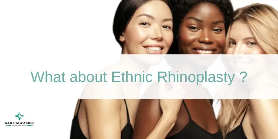 Ethnic rhinoplasty