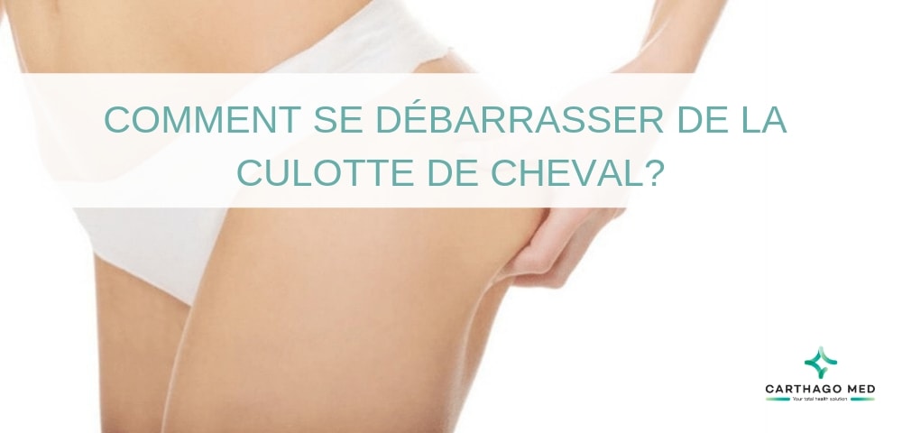 COMMENT SE DÉBARRASSER DE LA CULOTTE DE CHEVAL