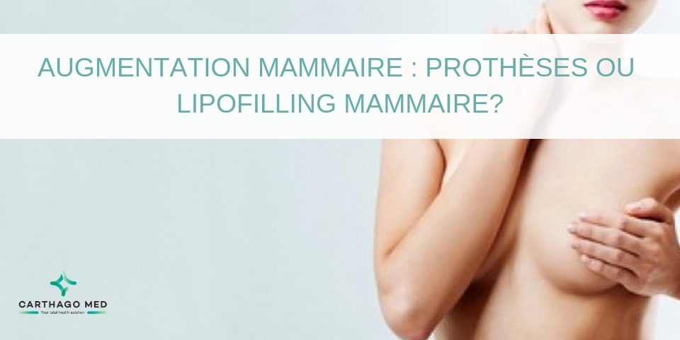 prothèses mammaires lipofilling - Carthago Med