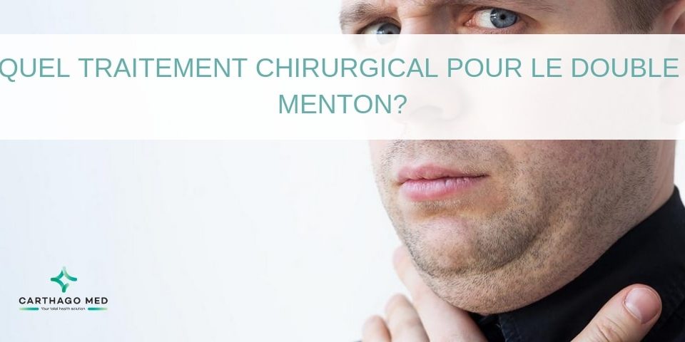 traitement chirurgical pour le double menton Carthago Med