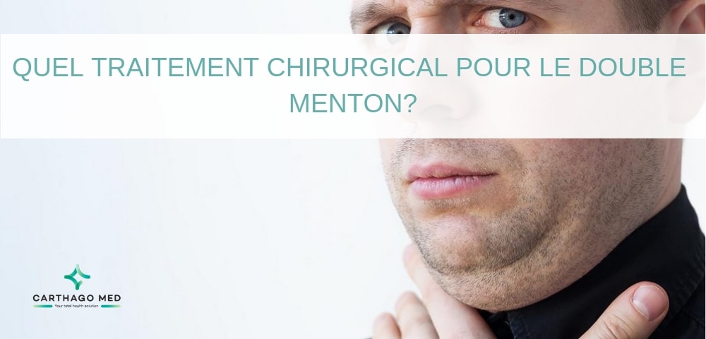 traitement chirurgical pour le double menton Carthago Med