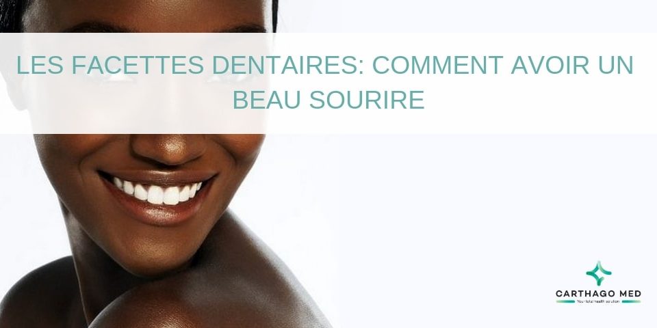 les facettes dentaires hollywood smile - Carthago Med