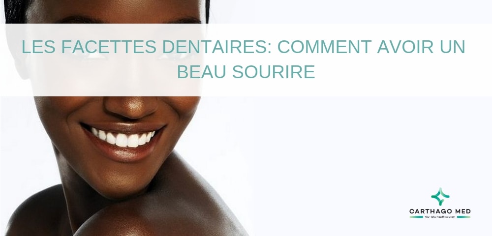 les facettes dentaires hollywood smile - Carthago Med