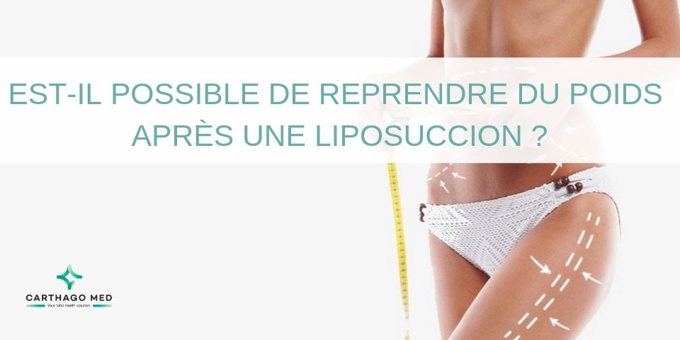 Reprendre-poids-après-liposuccion