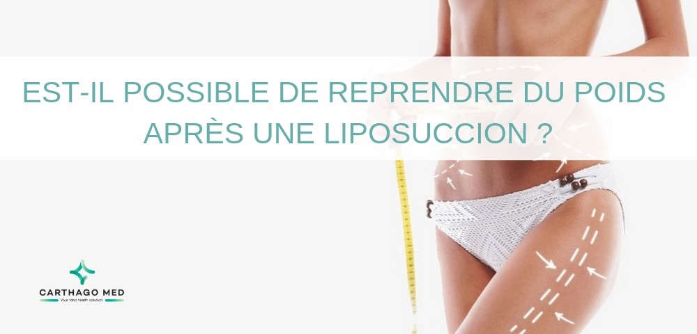 Reprendre-poids-après-liposuccion