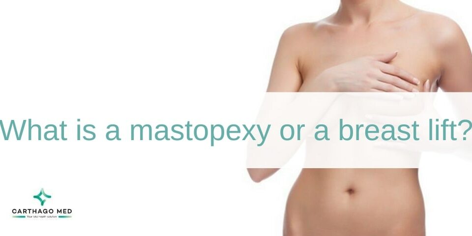 Mastopexy or breast lift