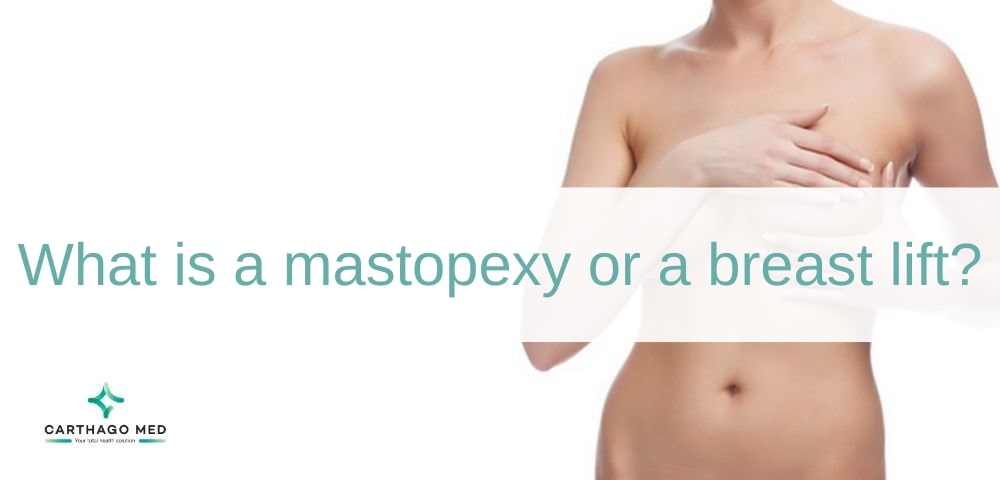 Mastopexy or breast lift