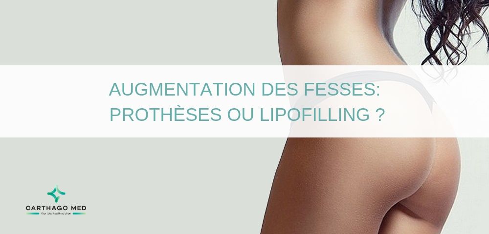 Augmentation des fesses - Carthago Med