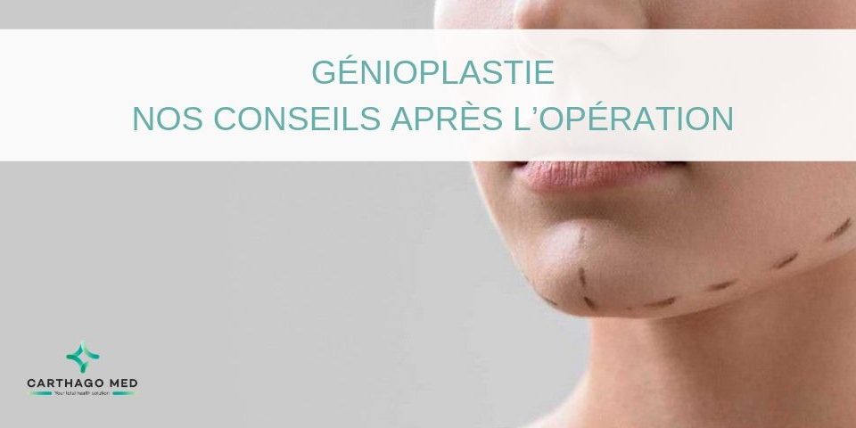 Génioplastie - Carthago Med