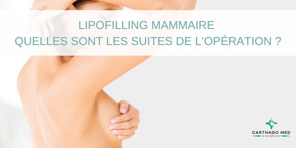 Lipofilling mammaire - Carthago Med