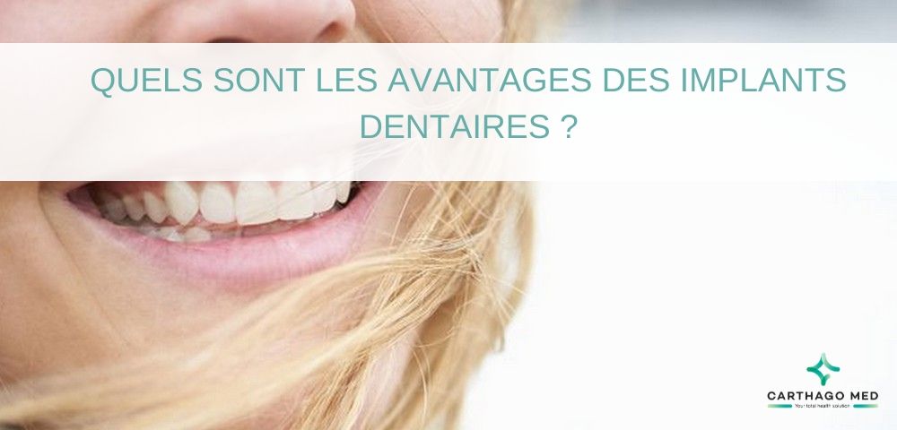 avantages des implants dentaires - Carthago Med