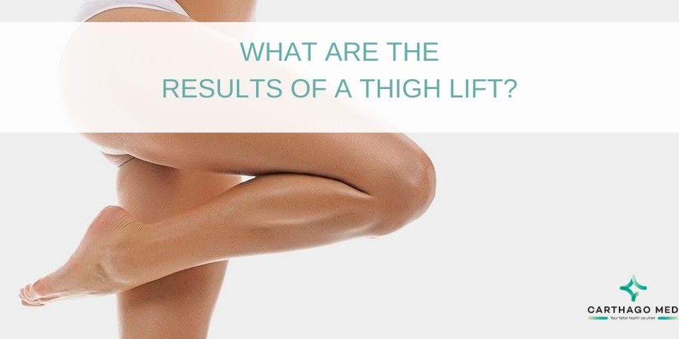 Thigh lifting