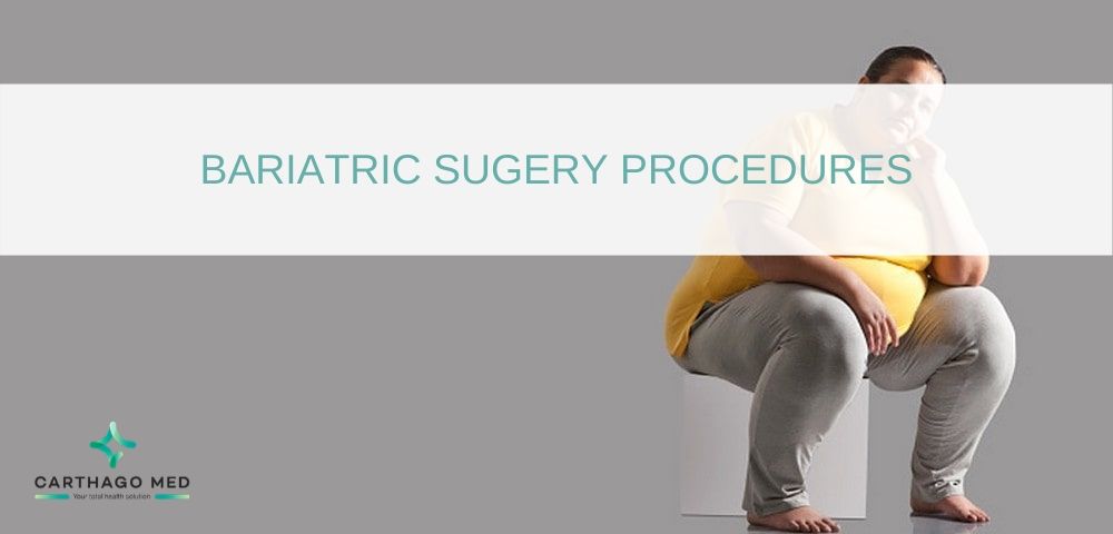 Bariatric surgery procedures