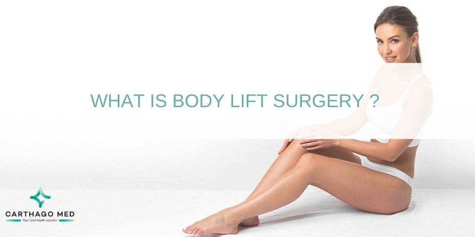 body-lift surgery