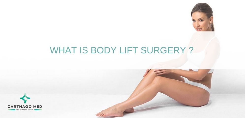 body-lift surgery