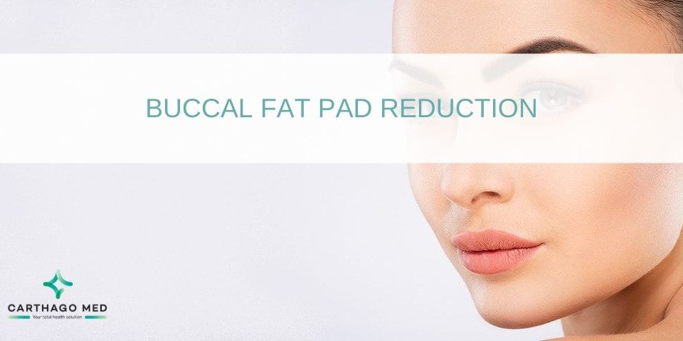 Buccal fat pad reduction