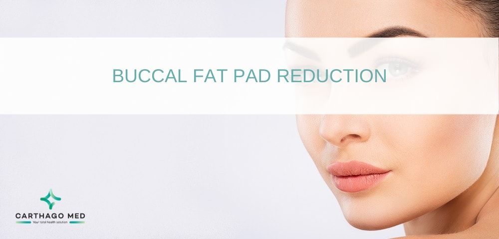 Buccal fat pad reduction