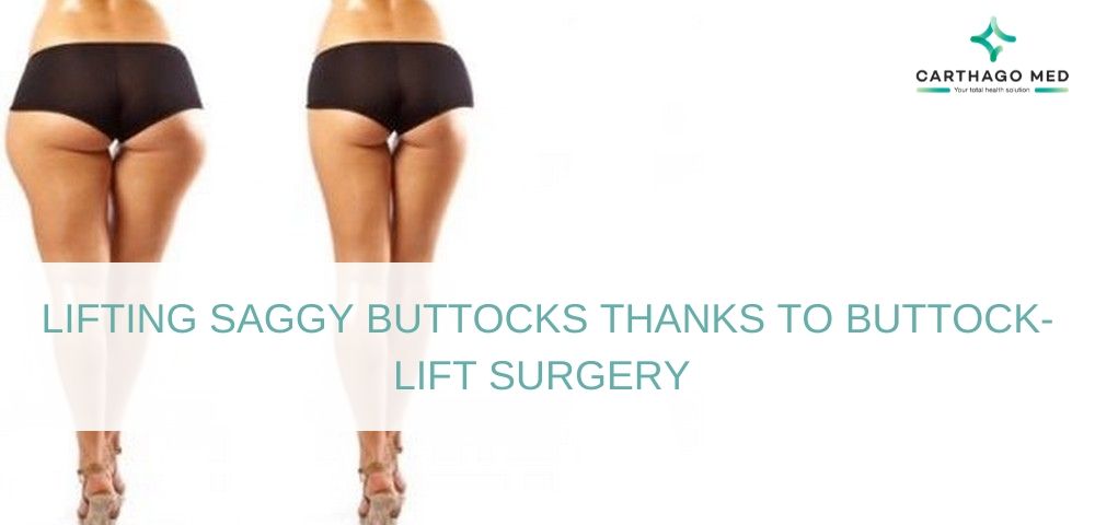 buttock-lift surgery