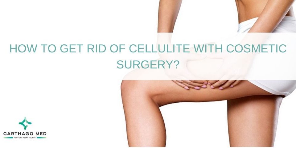 Cellulite Cosmetic Surgery