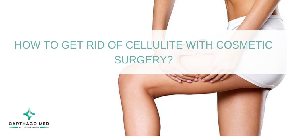 HOW TO GET RID OF CELLULITE WITH COSMETIC SURGERY