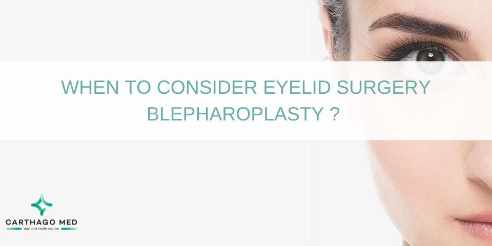 blepharoplasty