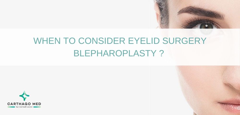 blepharoplasty