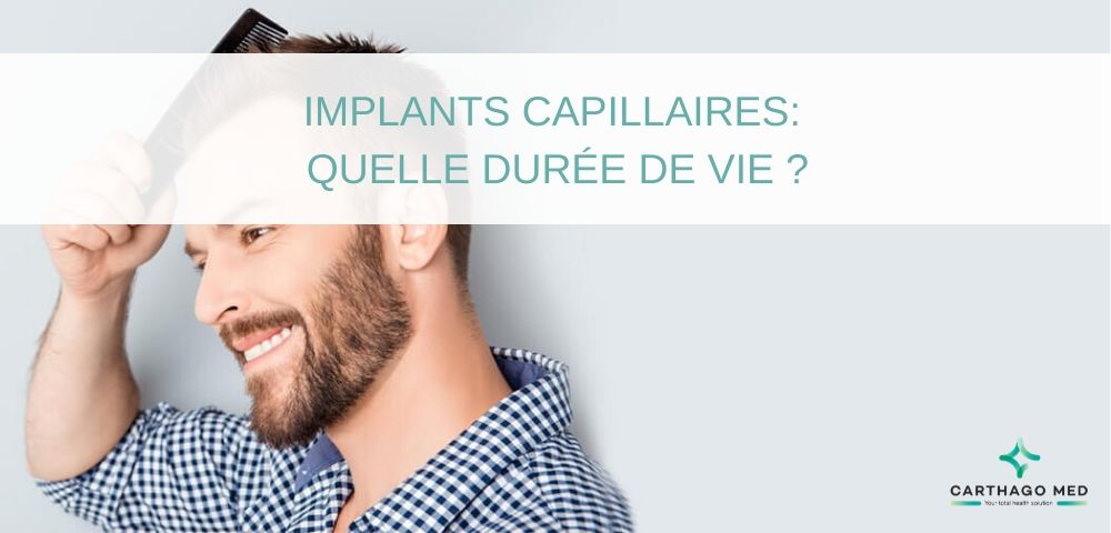 durée de vie des Implants capillaires - Carthago Med