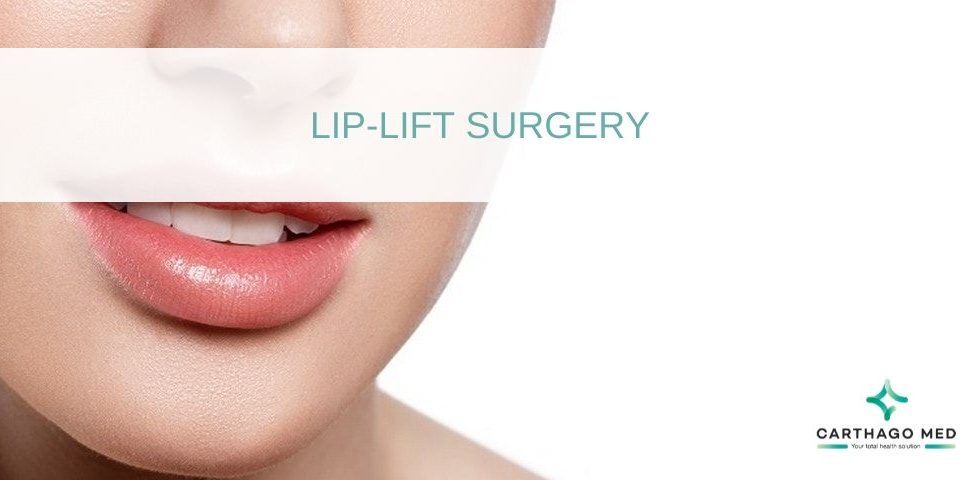 Lip lift surgery