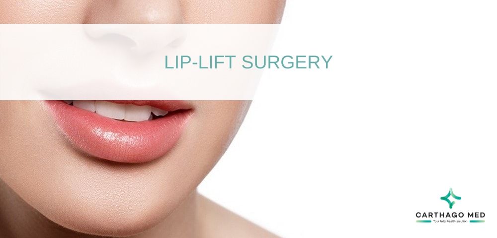 Lip lift surgery