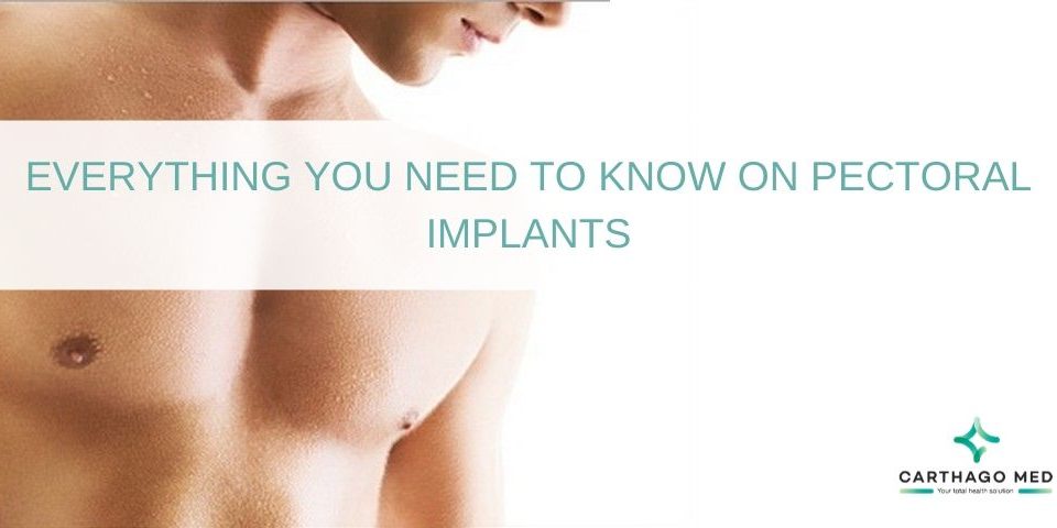 pectoral implants