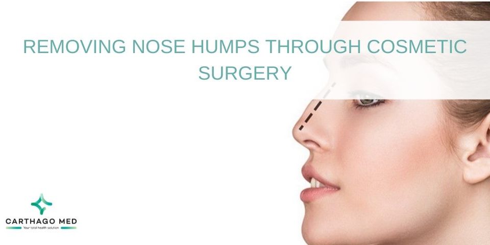 removing-nose