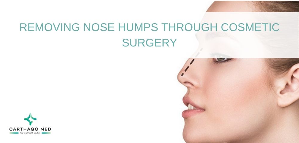 removing-nose