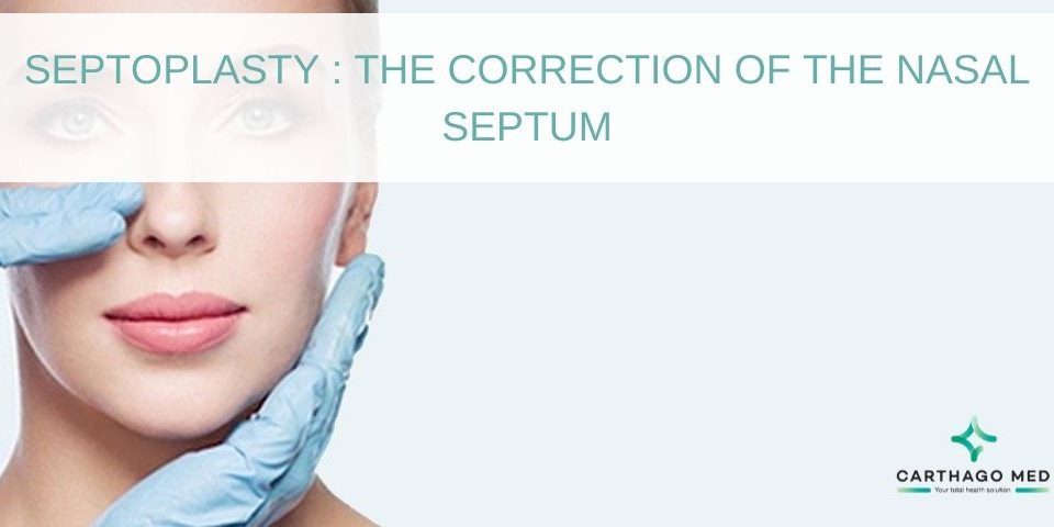 Septoplasty