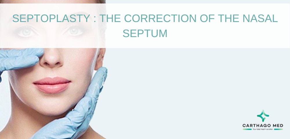 Septoplasty