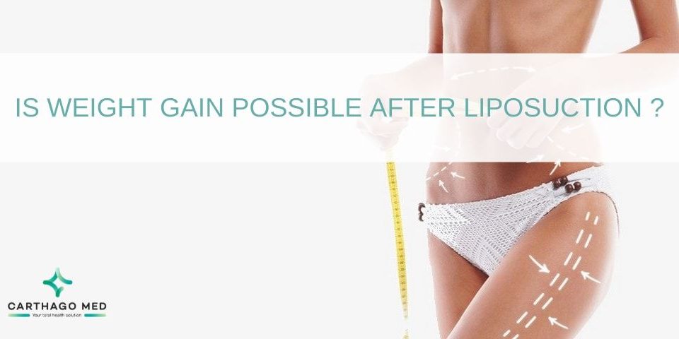 weight gain after liposuction