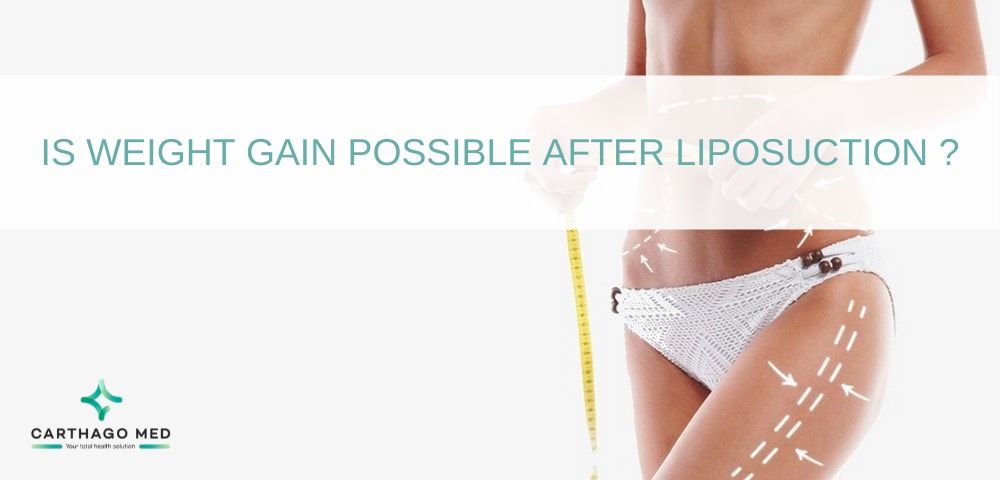 weight gain after liposuction