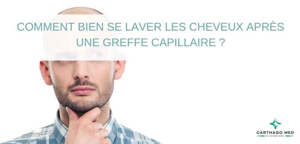 se laver les cheveux après une greffe capillaire - Carthago Med