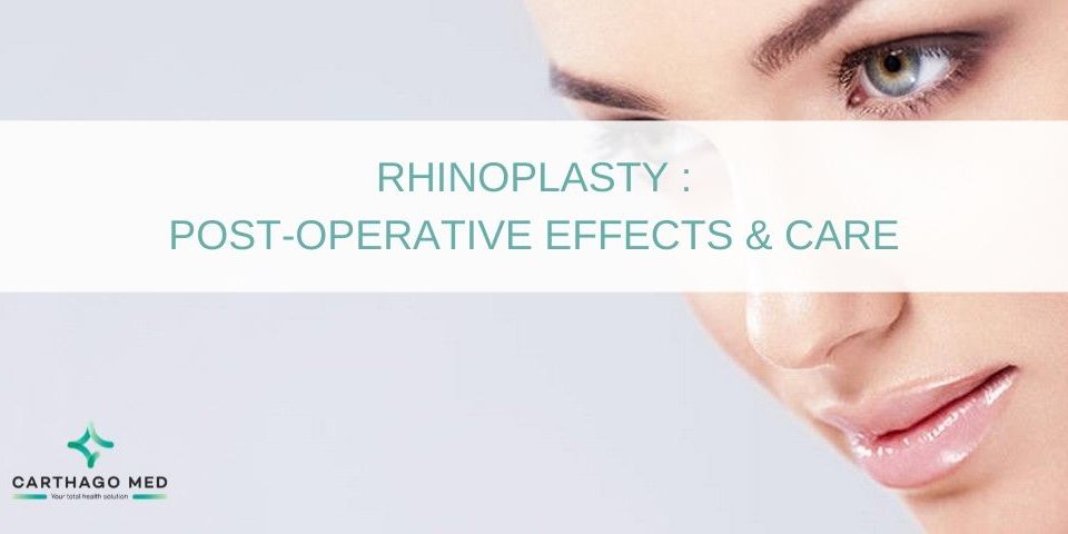 Rhinoplasty