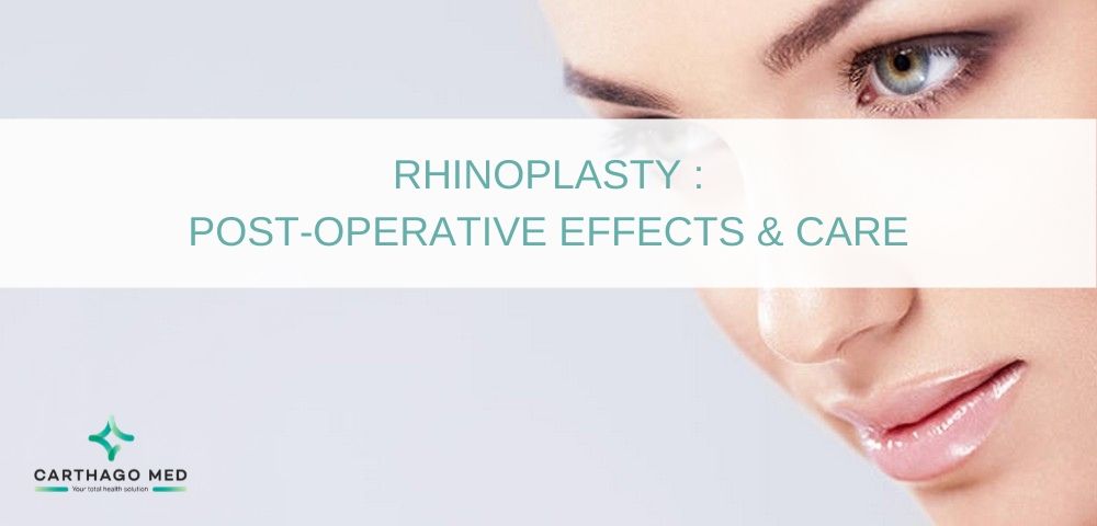 Rhinoplasty