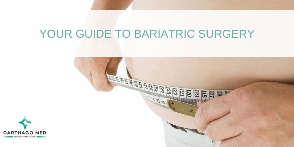 bariatric surgery guide