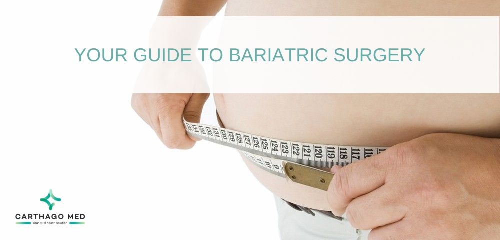 bariatric surgery guide