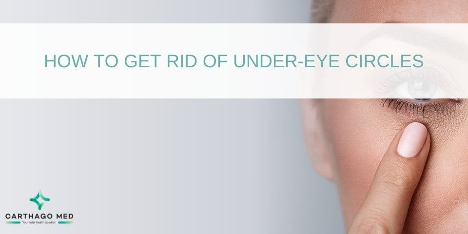 under-eye circles