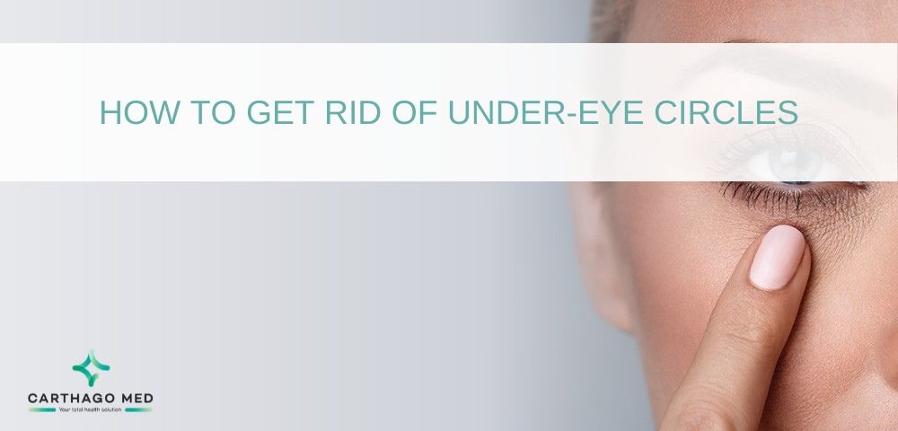 under-eye circles