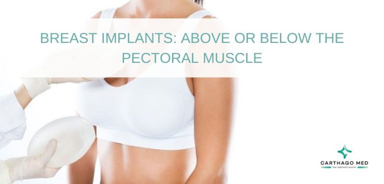 Huge Breast Implants Tumblr