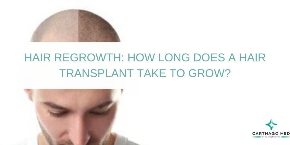 Hair transplant growth