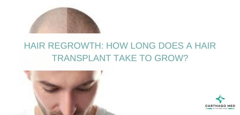 Hair transplant growth