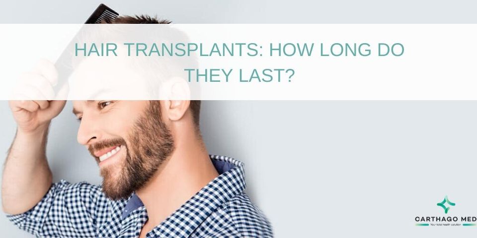 Hair Transplant Longevity