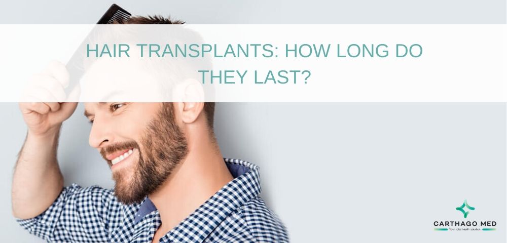 How Long Does the Transplanted Hair Last?