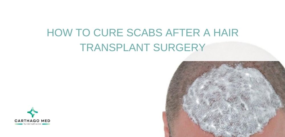 When & how can I remove scabs or crust after a hair transplant?